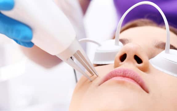 Laser Treatment for Acne Scars - ClearB5
