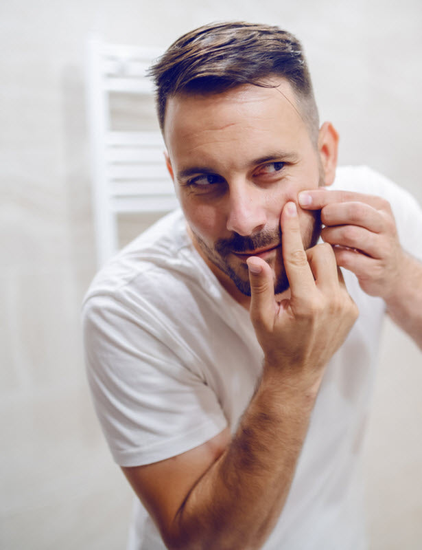 Adult male with mild acne and pimple